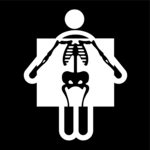 X-ray 2