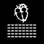 EKG 2
