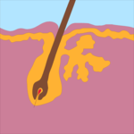 Skin - Cross Section 1