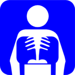 Chest X-Ray
