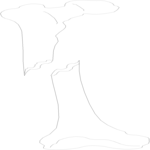 Leg - Spiral Fracture
