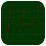EKG 1